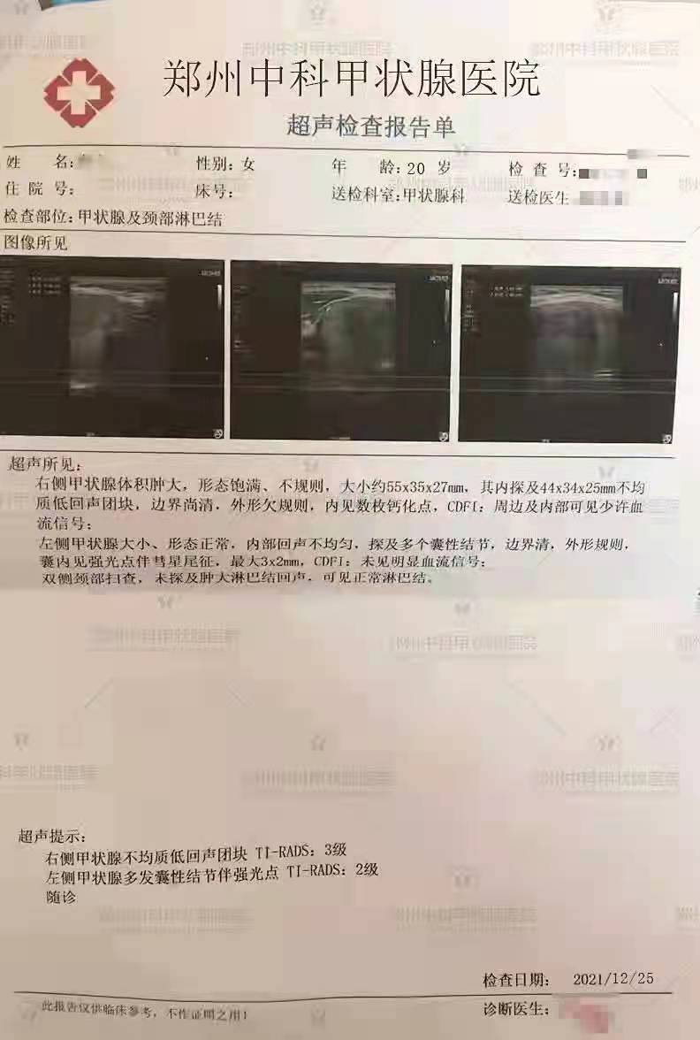 小姑娘查出甲状腺结节来消融,微波消融术治疗甲状腺结节适应症