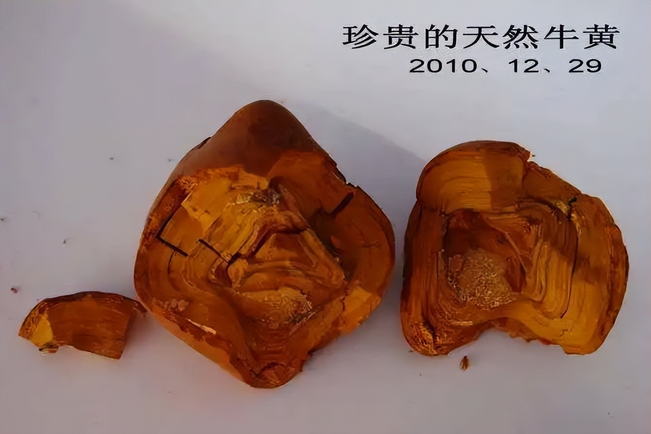 人工牛黄甲硝唑胶囊对牙疼有用吗,药店牙痛宁