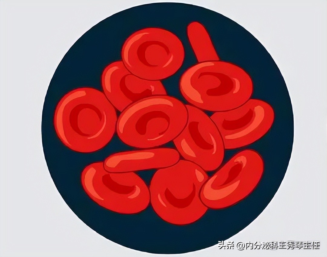 肾炎如何看懂尿常规化验单,看懂孕妇血尿常规化验单