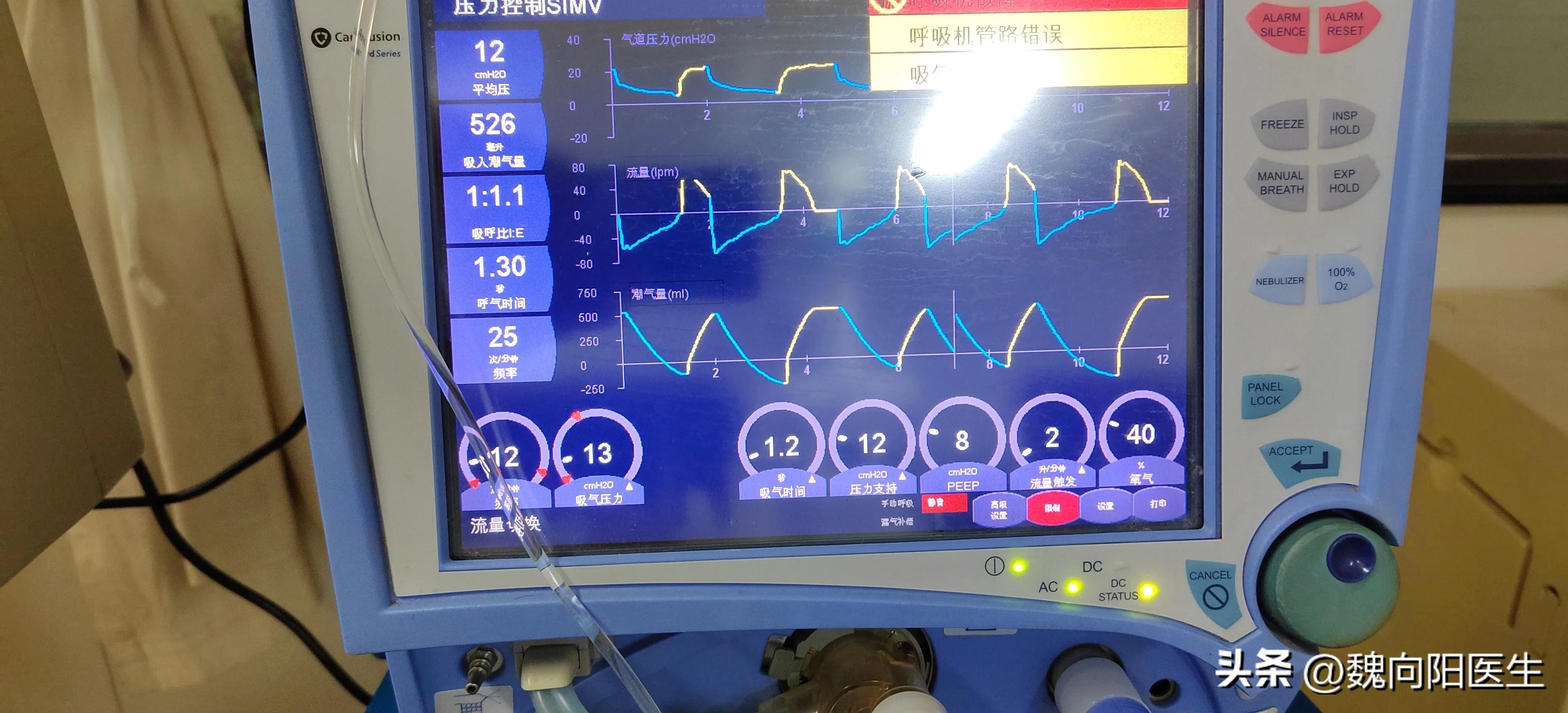 我的老父亲中风病危,我的父亲得了脑梗十九年
