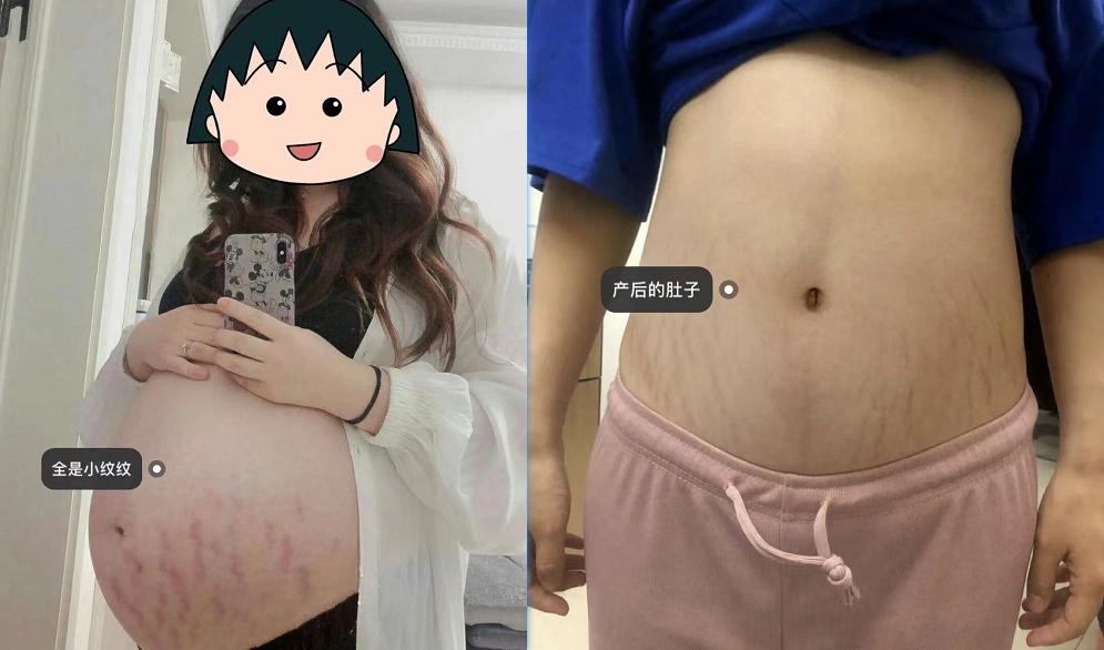 6款妊娠油推荐,妊娠油乳