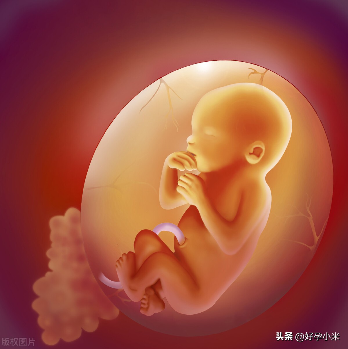 孕期见红的原因及处理方法