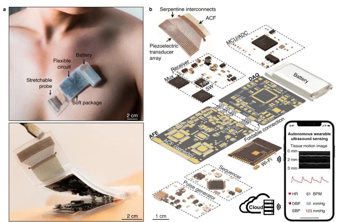 破多项纪录,首个可穿戴超声来了