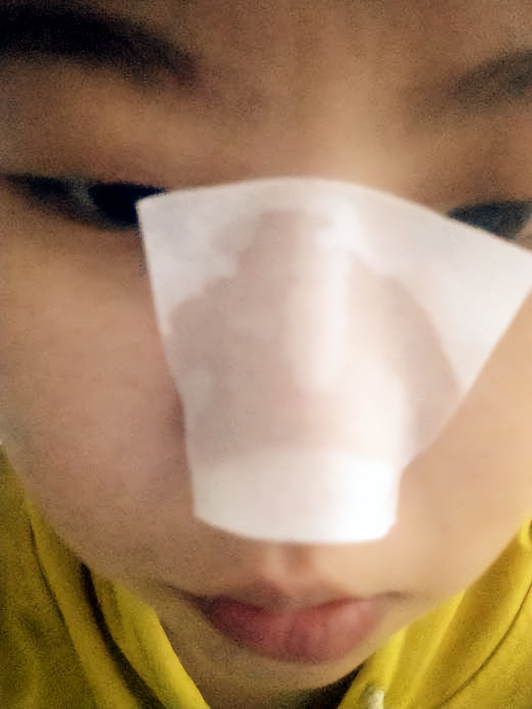 鼻子上挤出来的白色东西如何去除,鼻子上挤出来的白色分泌物是什么