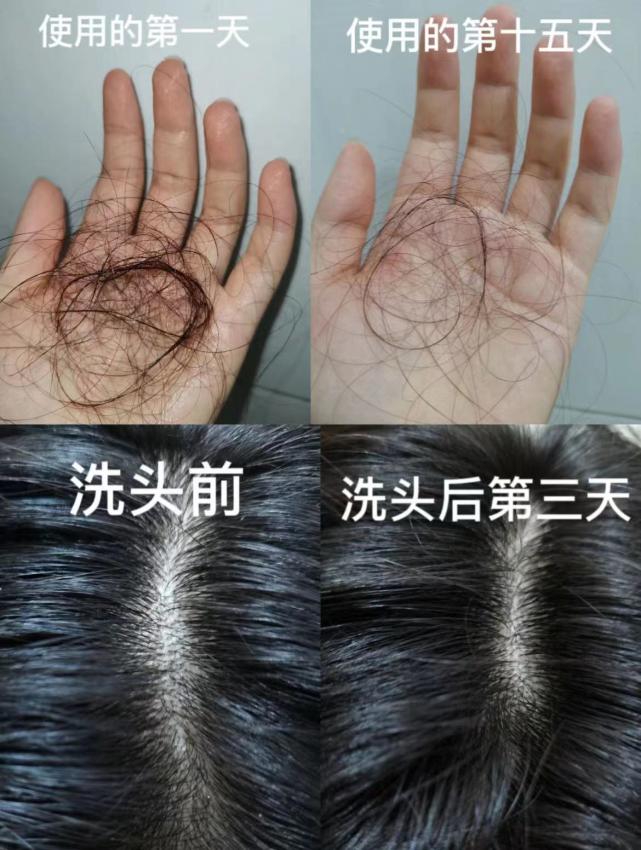 全网最好的防脱生发洗发水,洗发水推荐防脱生发改善毛躁