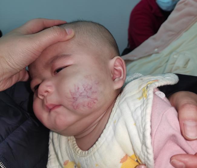 孩子身上出现不明红点,0-6岁的宝宝家长都应该关注哪些