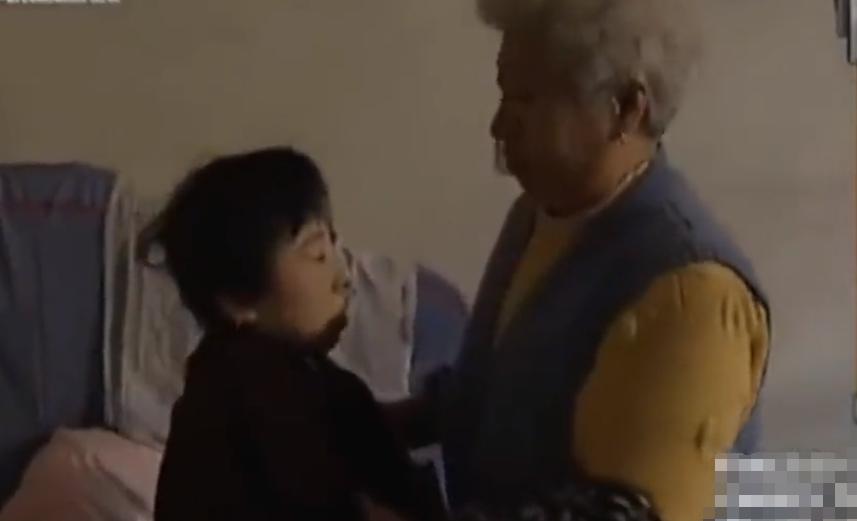 大连女孩怪病,29岁女子得怪病面容像80多岁