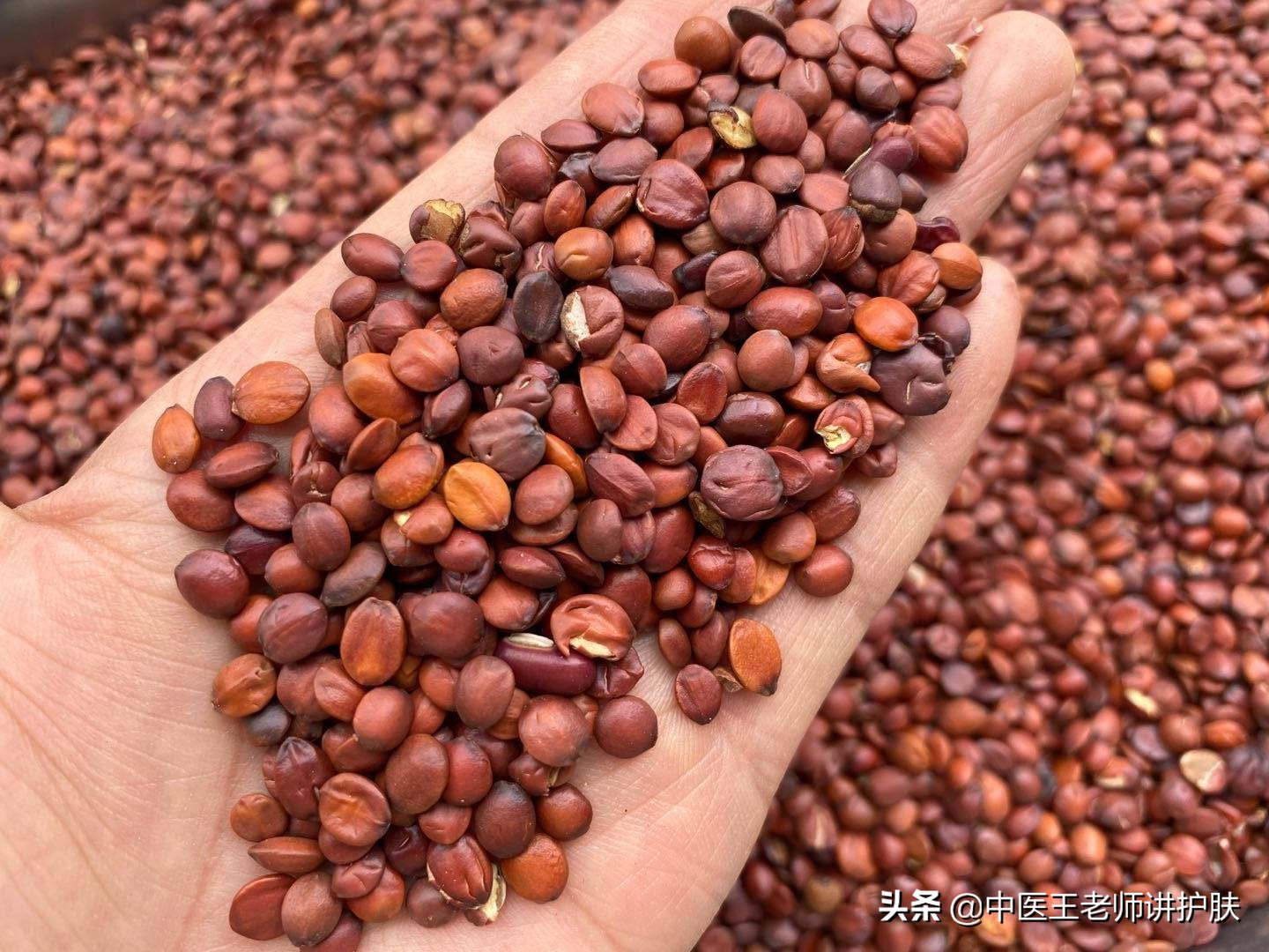 肝肾阴虚长斑怎么去掉,女人肝肾虚长斑怎么治