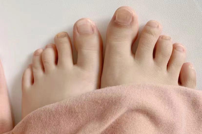 灰指甲治愈心得分享,分享自己根治灰指甲