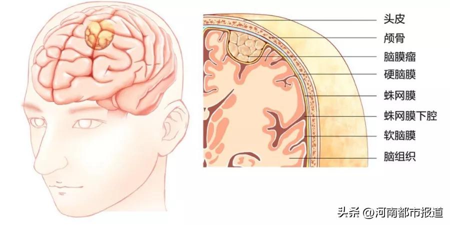 头晕头昏脑胀大脑不清是什么原因,突然头晕是大脑哪些信号