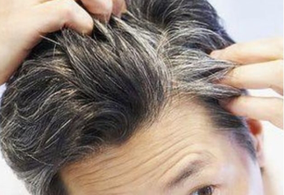 头发经常白发是因为什么,头发频繁出现白发怎么回事
