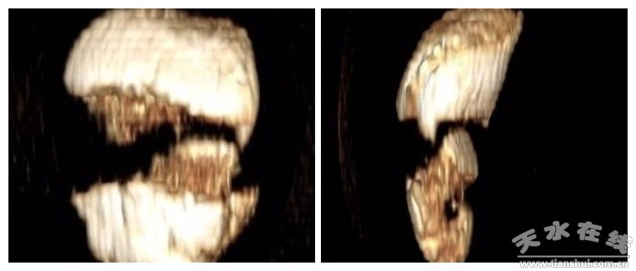 天水一院,天水市市一院