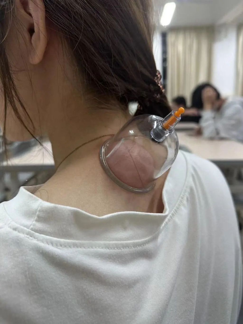 帅气老师扎头发,头发上拔罐的技巧