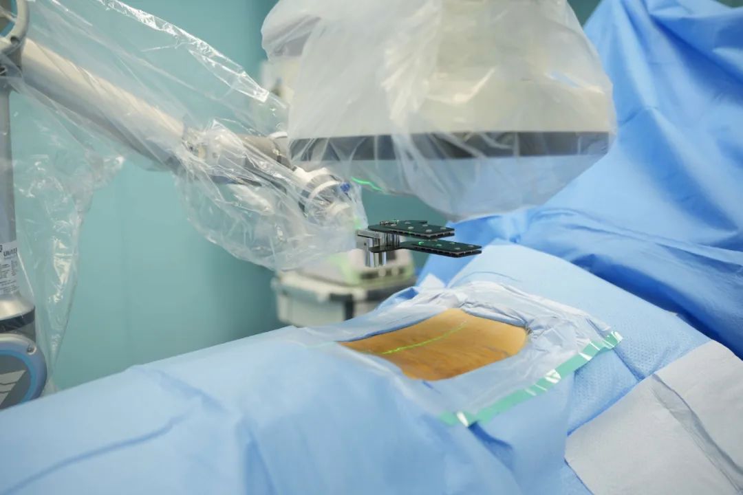 智能多功能骨科手术机器人,智慧微创骨科