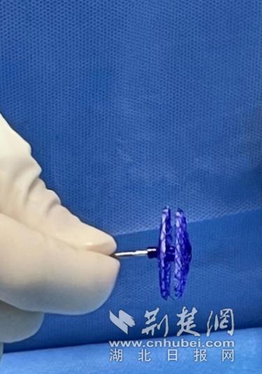 颈椎病防治误区,颈椎病的防治与误区