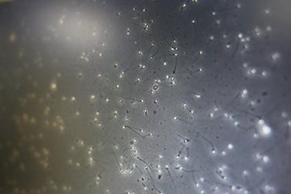 精子库人工授精纳入医保,弱精子症生育保险