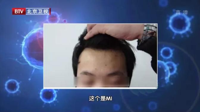 天天洗头容易脱发,天天洗头越来越油什么原因