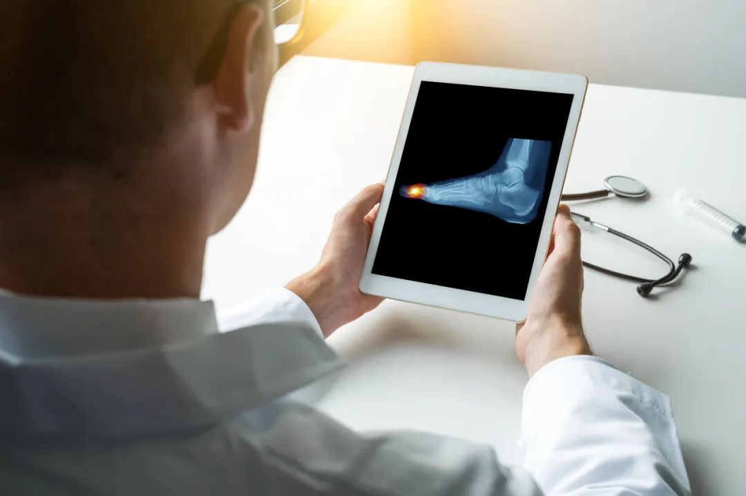 脚长得有点畸形,脚长歪了的图片