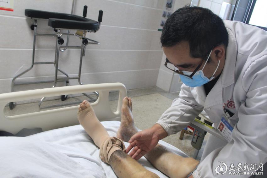 娄底市第一人民医院:射频消融微创术拯救8年不愈“老烂腿”