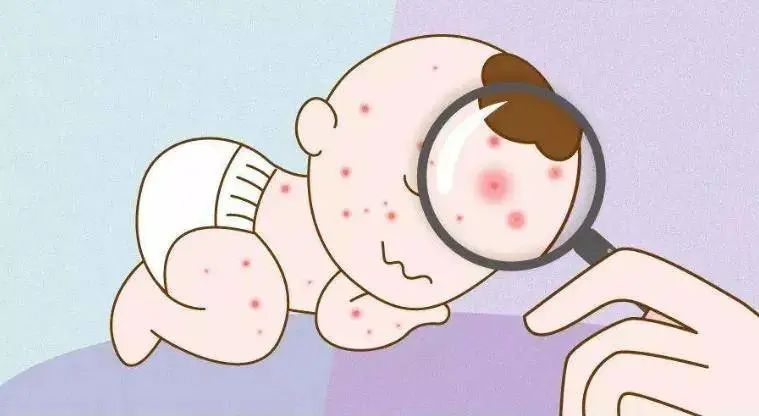 过敏性紫癜每个人都可能得吗,过敏性紫癜是不是过敏引起的