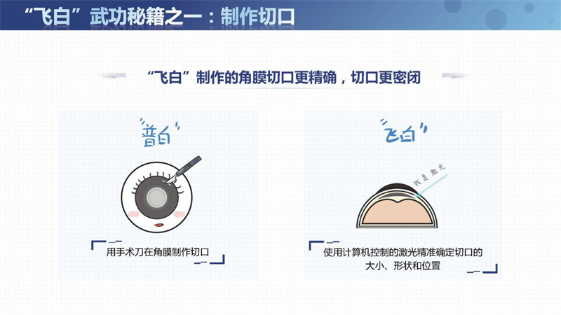 飞秒激光白内障老年人能不能做,第六人民医院飞秒白内障手术