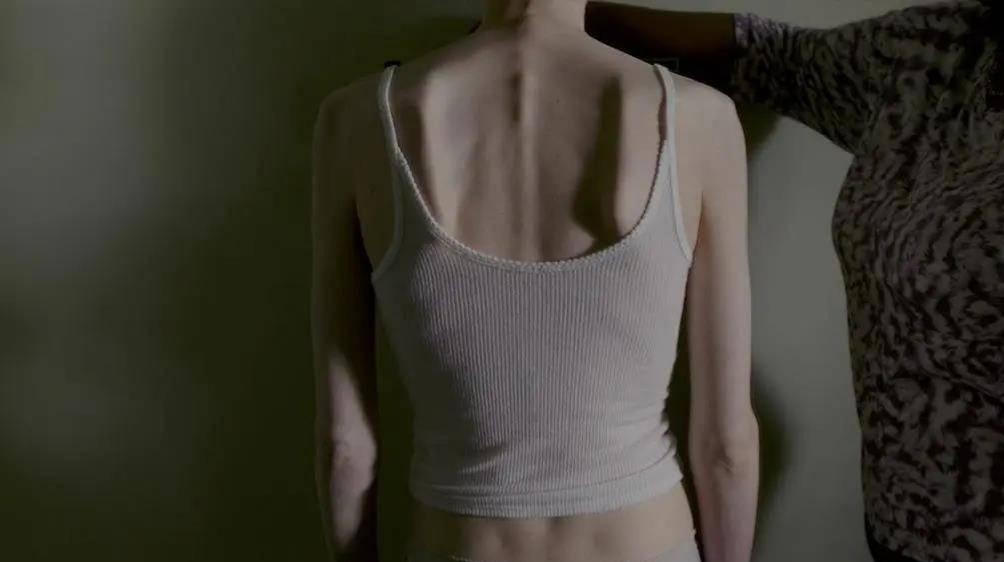 新型糖尿病药减肥,唯一被认定可以减肥的糖尿病药