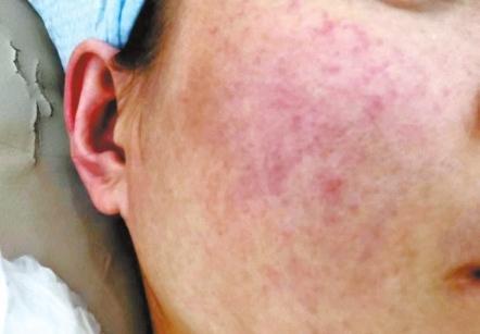 记者体验私人订制美容,记者体验免费皮肤排毒