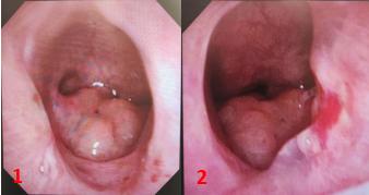 鼻孔是个“死胡同”，她出生4年才用鼻子呼吸到“第一口空气”
