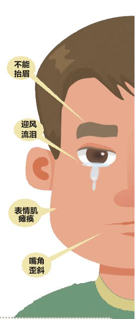 夏天谨防风扇直吹导致面瘫,夏天吹风扇或空调怎么避免面瘫