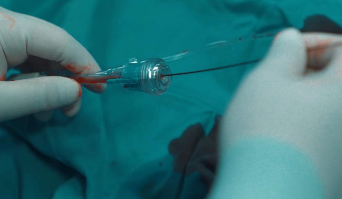 出血性疾病口诀,出血性疾病的鉴别诊断总结